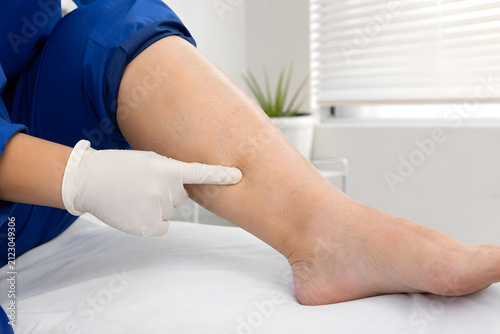 Clinician testing pitting edema on a swollen lower leg