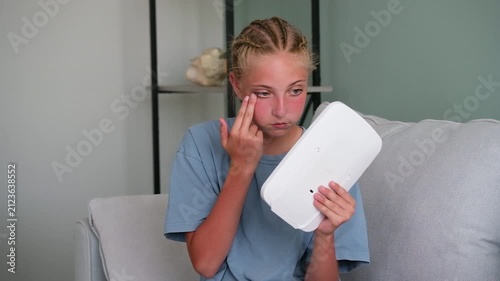 Girl was burned in sun. Sunburn. The teenager has a red face.
