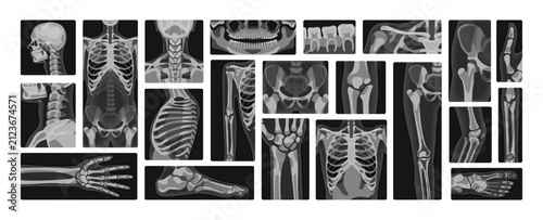 Foto X-rays set