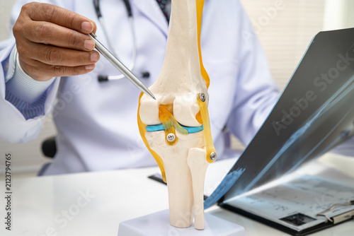 Konstfotografi Doctor examining knee joint bone radiography xray film.