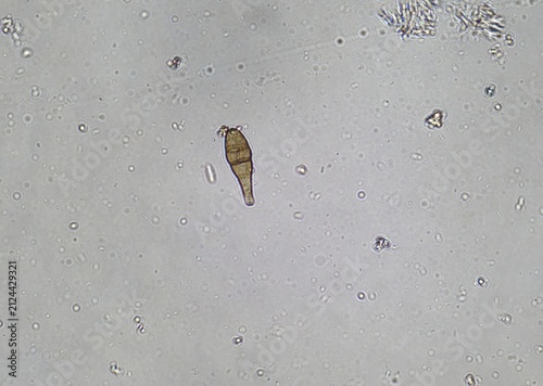 soil microorganisms under a microscope including amoeba, flagellates, nematodes, fungi, bacteria	