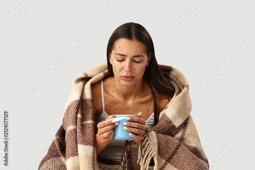 Young woman ill with chicke...