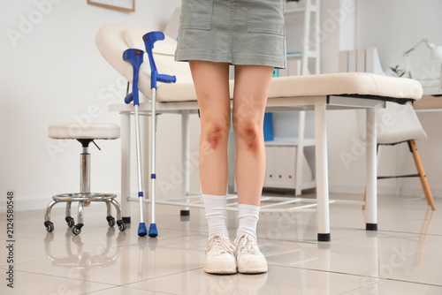 Young woman with bruised le...