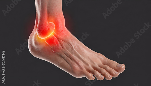 Painful Ankle Inflammation Medical Illustration