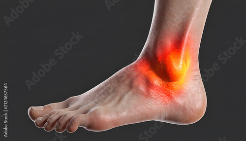 Painful Ankle Inflammation Medical Illustration
