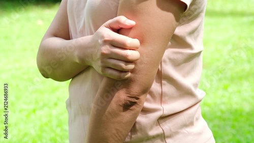 Woman was scratching her arm because she had a skin problem and was itchy from a fungal infection. Concept regarding health and skincare.