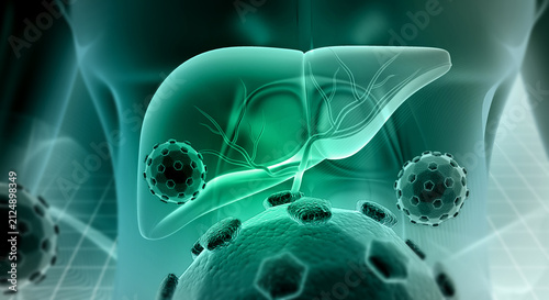 фотографія 3D medical illustration showing a diseased human liver infected with microscopic