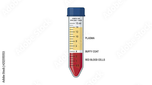 Cuadro en lienzo Blood Sample Centrifuged in Test Tube