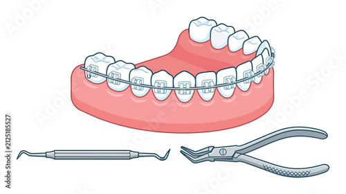 Quadro su tela Dental Braces and Tools Illustration