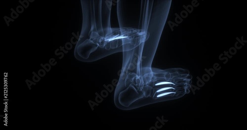 Lumbricals muscles of the foot in human body. X Ray. Loop