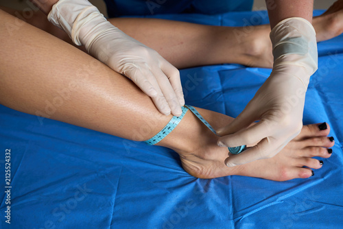 Картината върху платно Vascular surgeon assesses lower limb swelling by measuring the ankle circumferen
