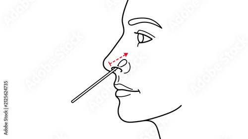 Bild auf Leinwand Line Art Illustration of Nasal Swab Test