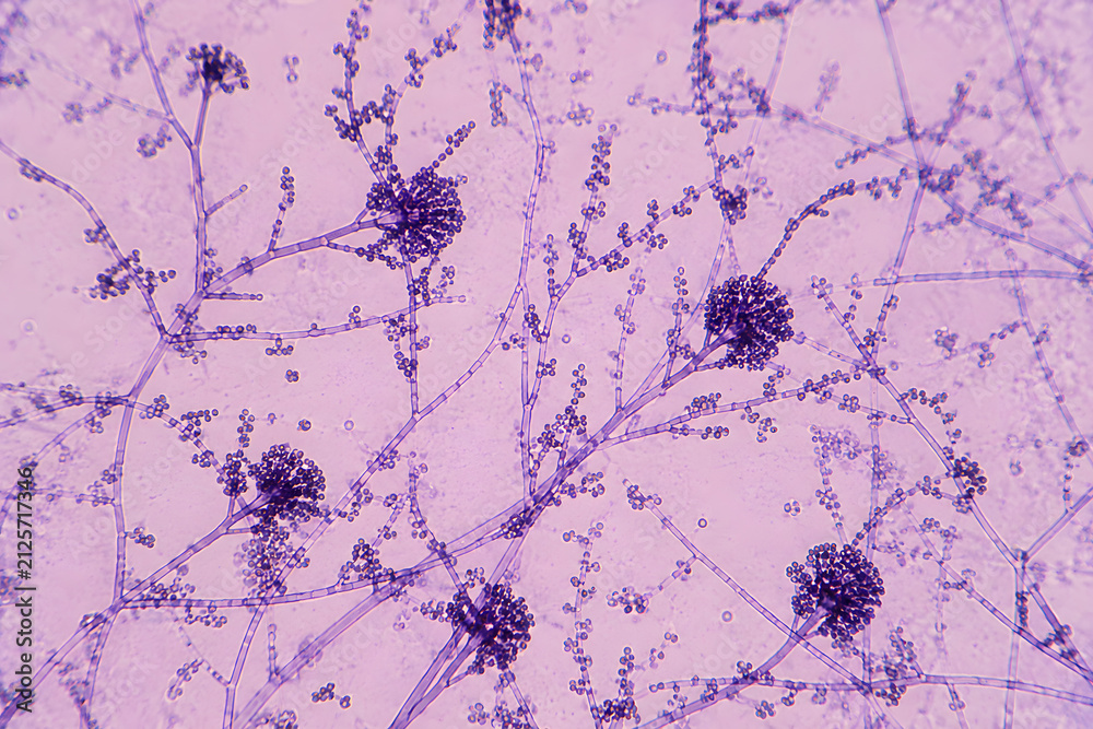 Naklejka premium Microscope image showing branching fungal hyphae with dense spore clusters, illustrating mycology, microbiology, laboratory diagnostics, fungal infections, and biological research.