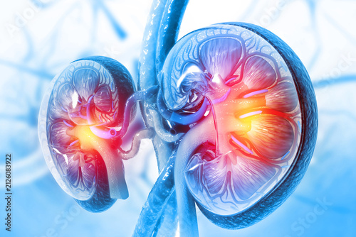 Chronic Kidney Disease. Medical organ. Cross section. 3d illustration