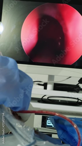 Laparoscopy surgery procedure demonstration on device screen closeup. Doctor conducts invasive treatment of patient in hospital vertical shot