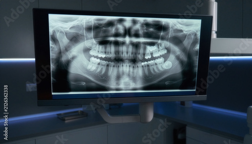 Modern computer monitor displaying a clear panoramic dental radiogram scan in a clinical laboratory setup, perfect for dentistry industry, oral hygiene, and jawbone structure concepts