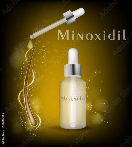 Modern medical vector illustration of a topical minoxidil solution in a dropper bottle with a pipette dispensing serum onto a hair follicle. The composition symbolizes hair loss treatment