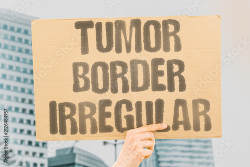 Quadro su tela "Tumor Border Irregular" Malignant margins are often jagged and ill-defined