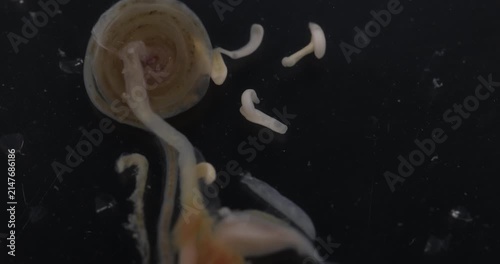 Cestode Larva (Cysticercus) and Strongyloides ratti Parasites in lab.