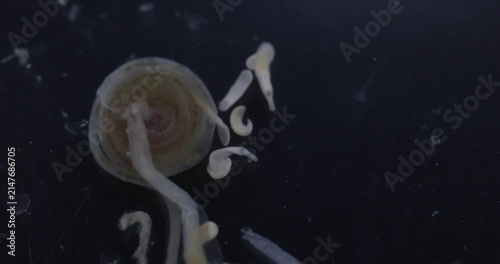 Cestode Larva (Cysticercus) and Strongyloides ratti Parasites in lab.