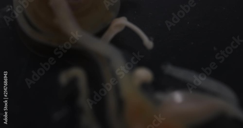 Cestode Larva (Cysticercus) and Strongyloides ratti Parasites in lab.