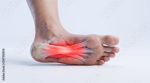 Bottom View of Human Foot Showing Plantar Fascia Anatomy and Foot Arch