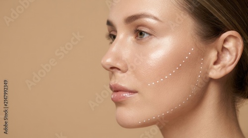 Cosmetic dots mark contours for a lifting procedure as a beauty model receives skin rejuvenation.