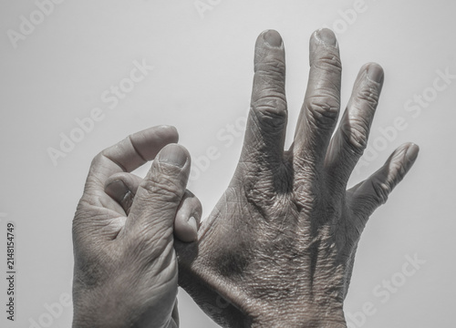 Finger of seniors who have problems trigger fingers
