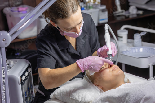 Obraz na plátně Professional cosmetologist performs hydradermabrasion around the nose using a vacuum facial device for deep pore cleansing, exfoliation and skin rejuvenation