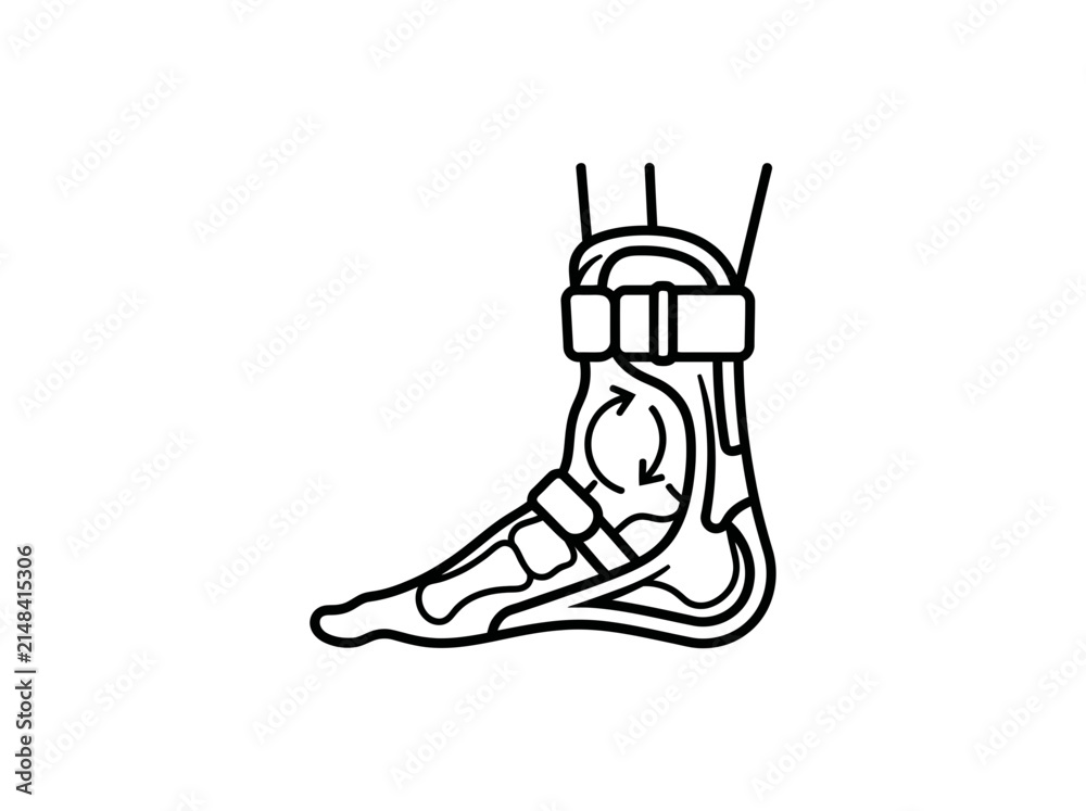 Obraz premium Ankle brace supporting a human foot demonstrates the recovery and stabilization process required for treating joint injuries or providing orthopedic relief during medical rehabilitation.
