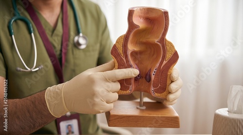 Male doctor holding an anatomical model of the human rectum, proctology consultation and medical education