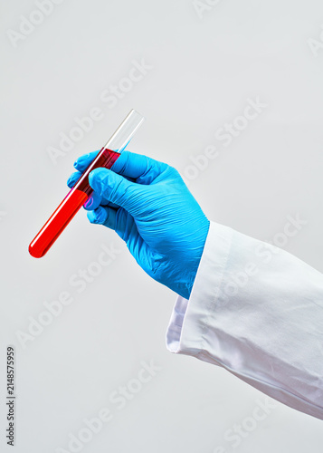 Hand in blue protective glove holding test tube with red liquid, closeup detail