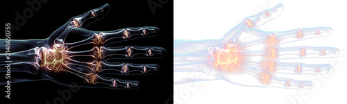 Obraz na płótnie Detailed 3D medical illustration of a human hand X-ray showing inflamed glowing wrist and finger joints, suitable for healthcare and arthritis pain concept PNG isolated on transparent background