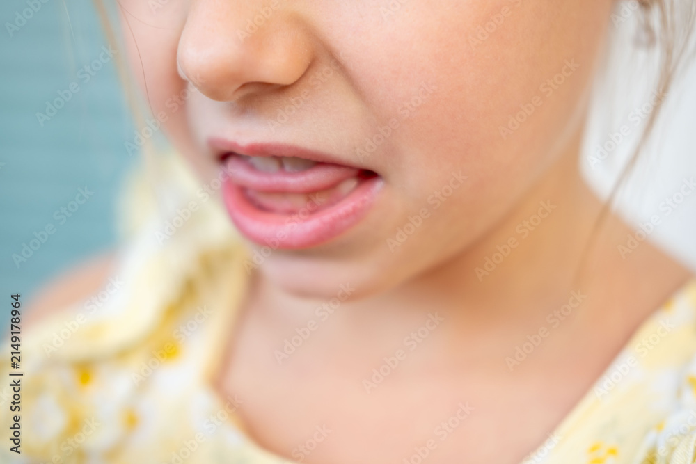 Obraz premium close up little girl mouth and teeth, funny facial expression, kids dental health, pediatric dentistry care, showing teeth and tongue during playful moment, cute child portrait, emotions and feelings