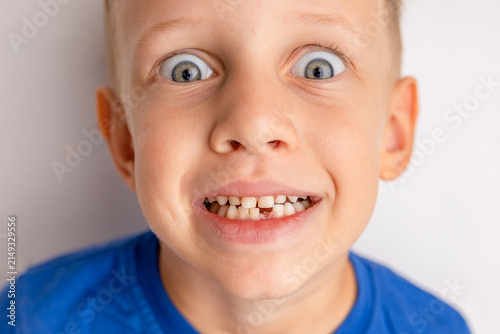 Child with missing front milk tooth smiling broadly. Young boy showing gap in teeth after losing tooth. Growing up, childhood development, dental hygiene and oral health care concept.