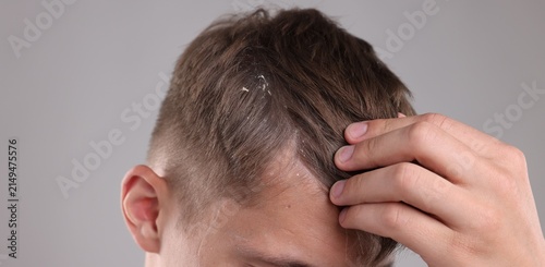 Quadro su tela Dandruff problem