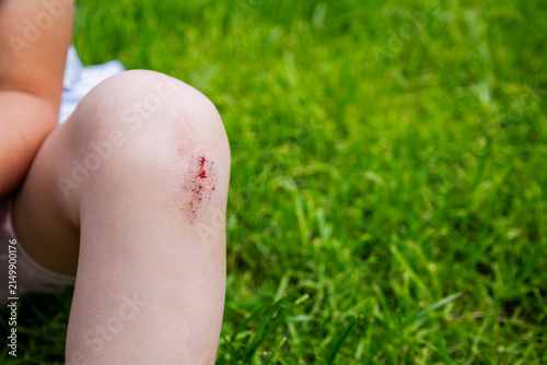 Close up of child scraped knee wound with dirt on green grass background.