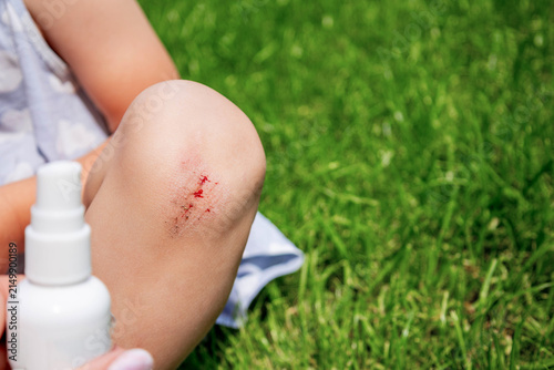 Spraying antiseptic on child scraped knee wound with green grass background.