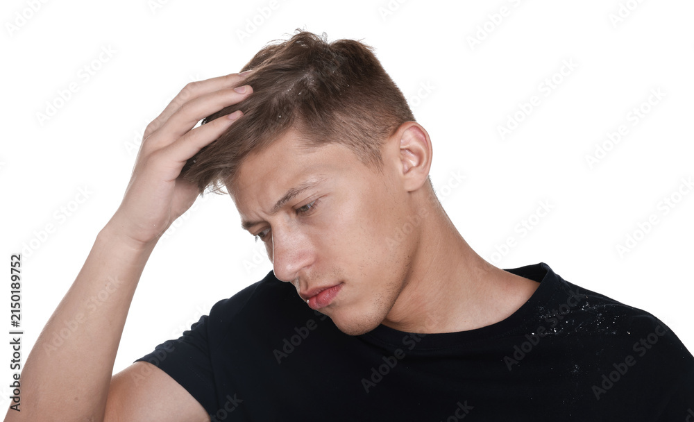 Fototapeta premium Unhappy man suffering from dandruff on white background