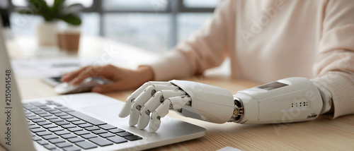Robotic prosthetic hand typing on a laptop keyboard modern technology scene artificial limb bionic device arm mechanical cybernetic replacement prosthesis automation future innovation