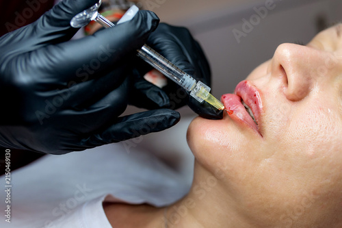 фотографія Professional lip filler injection procedure performed by an aesthetic specialist