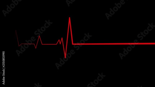 Electrocardiogram Heartbeat Wave Animation with Medical Signal Line
