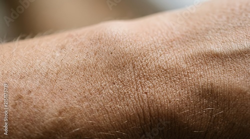 Close up view of dry and dehydrated human skin texture on forearm.