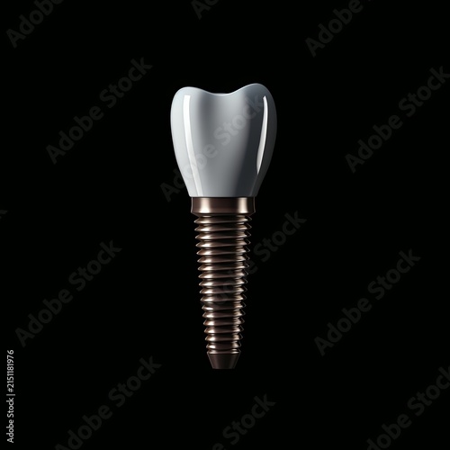 Realistic Dental Implant on Black Background for Medical and Healthcare Concepts
