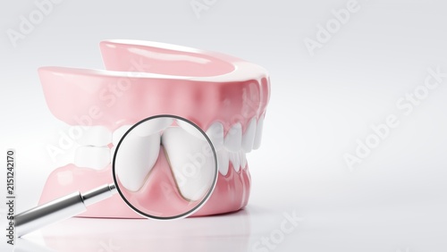 Foto Magnifying glass focusing on inflamed gum disease and plaque on human teeth model