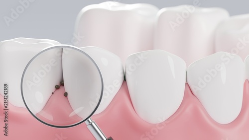 Foto Magnifying glass zooming in on plaque and bacteria between human teeth