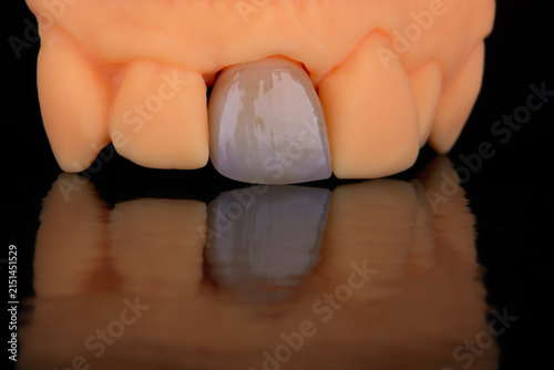 Fotografía Mirror copy of central maxillary incisor, ultra thin dental ceramic veneer or cr