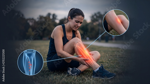 Woman suffering from shin splint pain while exercising outdoors