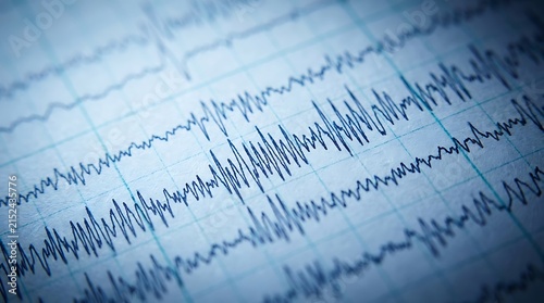 Medical EEG brain wave scan results showing neurological activity on paper graph