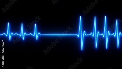 Blue glowing heartbeat line stopping into a flatline and then restarting on a black background, concept of cardiac arrest and resuscitation, life and death